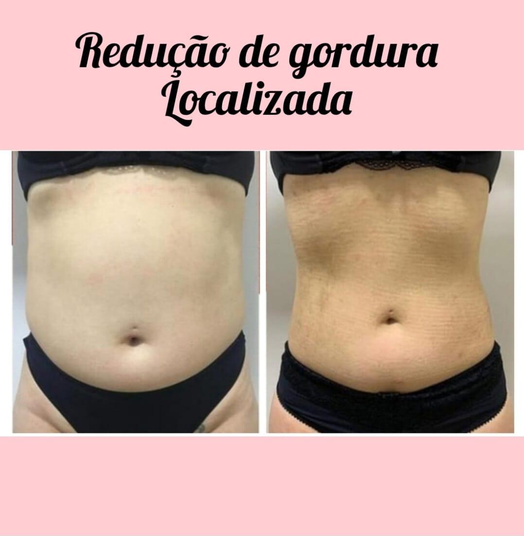 Clínica de estética Vanessa perotto